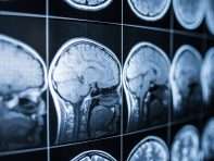 traumatic brain injury