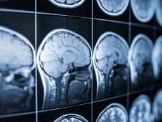 traumatic brain injury