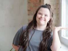 adult down syndrome