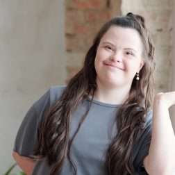 adult down syndrome