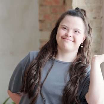 adult down syndrome