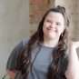 adult down syndrome